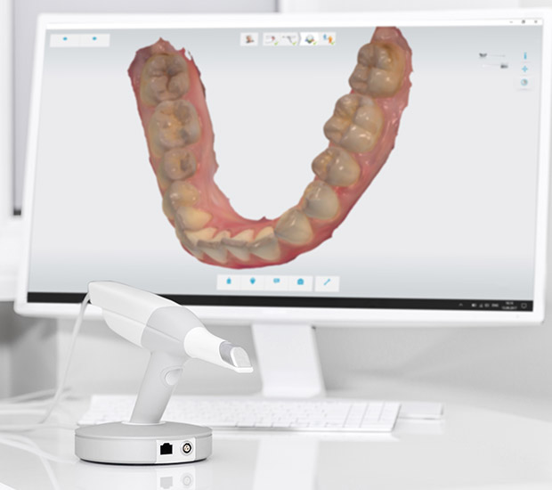 Dunellen 3D Cone Beam and 3D Dental Scans