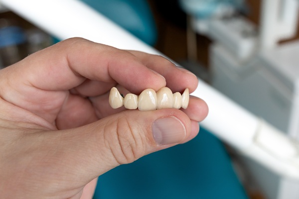 Are Dental Bridges The Right Choice For Me?